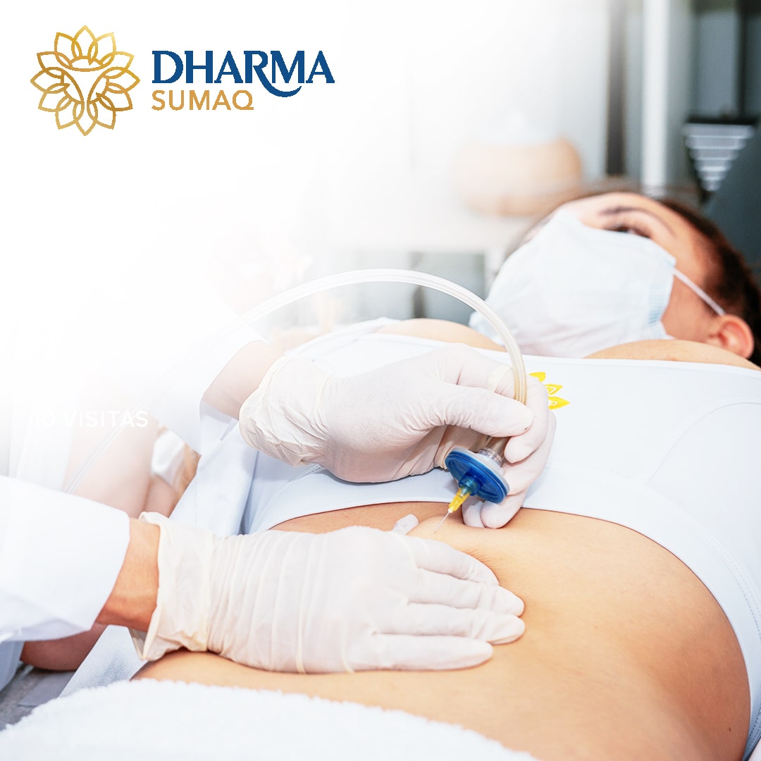 CARBOXITERAPIA DAMAS-min