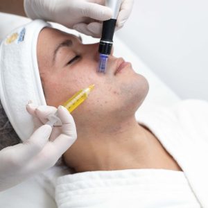 PLASMA RICO EN PLAQUETAS + DERMAPEN