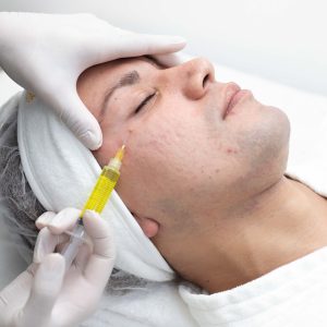 PLASMA RICO EN PLAQUETAS + ACIDO HIALURONICO HIDRATANTE