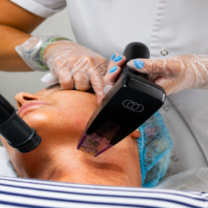 Morpheus 8 +PRP: CUELLO + ESCOTE