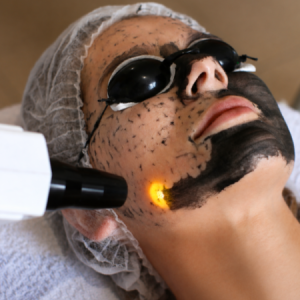 HOLLYWOOD PEEL